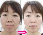 �r�t�H�[�A�t�^�[�P